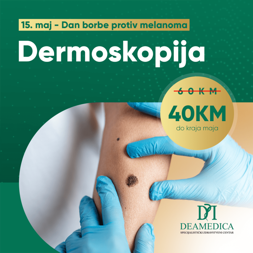 Zakažite dermoskopiju