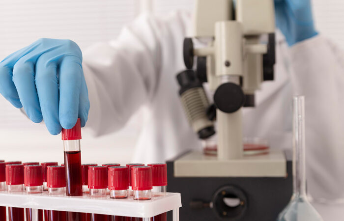 Hematološka ambulanta u ZU Deamedica Banja Luka