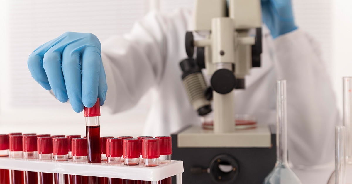 Hematološka ambulanta u ZU Deamedica Banja Luka