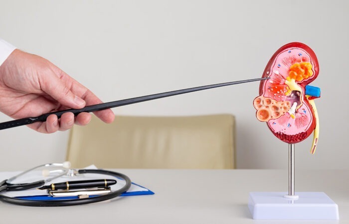 Nefrološka ambulanta ZU Deamedica Banja Luka