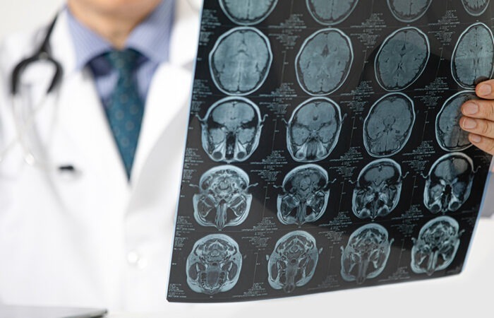 Neurološka ambulanta ZU Deamedica Banja Luka