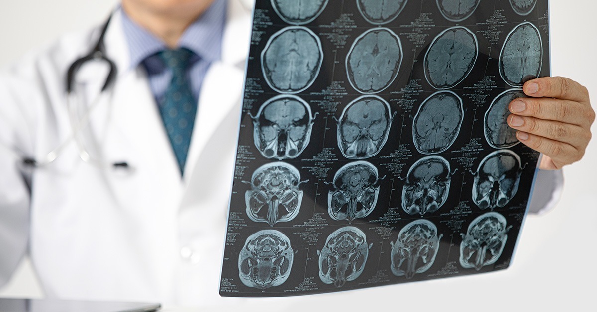 Neurološka ambulanta ZU Deamedica Banja Luka